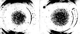 human umbilical vein endothelial cells cultured 4 days